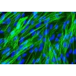 Human Bronchial Smooth Muscle Cells (HBSM) - Immunostaining for α-sma, 400x.
