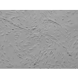 Human Cardiac Fibroblasts-juvenile ventricular (HCF-av) - Relief contrast, 100x.