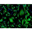 Human Cardiac Microvascular Endothelial Cells (HCMEC) - Immunostaining for vWF, 200x.
