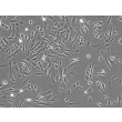 Human Choroid Plexus Epithelial Cells (HCPEpiC) - Phase contrast, 100x.
