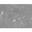 Human_Dermal_Fibroblasts-adult (HDF-a) - Phase contrast, 200x.
