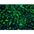 Human Dermal Lymphatic Endothelial Cells (HDLEC) - Immunostaining for vWF, 200x.
