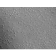 Human Dermal Microvascular Endothelial Cells (HDMEC) - Relief contrast, 100x.

