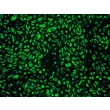 Human Dermal Microvascular Endothelial Cells-adult (HDMEC-a) - Immunostaining for vWF, 100x.
