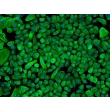Human Epidermal Keratinocytes-neonatal (HEK-n) - Immunostaining for CK-18, 200x.
