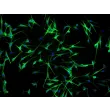 Human Epidermal Melanocyte-adult (HEM-a) - Immunostaining for S100-β, 100x.

