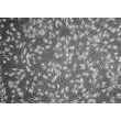 Human Epidermal Melanocytes-dark (HEM-d) - Phase contrast, 100x.
