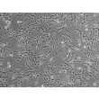 Human Gallbladder Fibroblasts (HGBF) - Phase contrast, 100x.
