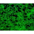 Human Gingival Fibroblasts (HGF) - Immunostaining for Fibronectin, 200x.
