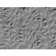 Human Hair Follicular Keratinocytes (HHFK) - Relief contrast, 400x.

