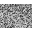 Human Hair Follicular Keratinocytes (HHFK) - Phase contrast, 200x.
