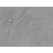 Human Hair Outer Root Sheath Cells (HHORSC) - Relief contrast, 400x.
