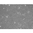Human Hepatocytes (HH) - Phase contrast, 100x.
