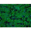 Human Hepatocytes (HH) - Immunostaining for CK-18, 100x.
