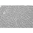 Human Intestinal Smooth Muscle Cells (HISMC) - Phase contrast, 200x.
