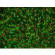Human Intrahepatic Biliary Epithelial Cells (HIBEpiC)-Immunostaining for CK-19 (Sigma-Aldrich, Cat. #C6930), 200x.
