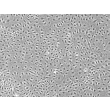 Human Lymphatic Endothelial Cells (HLEC) - Phase contrast, 100x.
