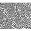 Human Lymphatic Fibroblasts (HLF) - Phase contrast, 200x.
