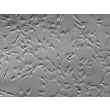 Human Meningeal Cells (HMC) - Relief contrast, 200x.
