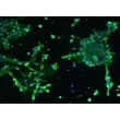 Human Oligodendrocyte Precursor Cell-oligospheres (HOPC-os) - Immunostaining for A2B5 after differentation for 1 day, 100x..

