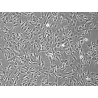Human Osteoblasts-femoral (HO-f) - Phase contrast, 100x.
