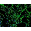 Human Osteoblasts-femoral (HO-f) - Immunostaining for Fibronectin, 200x.
