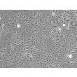 Human Pancreatic Microvascular Endothelial Cells (HPaMEC)-Phase Contrast, 100x.

