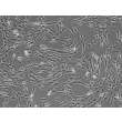 Human Pancreatic Stellate Cells (HPaSteC) - Phase contrast, 200x.
