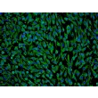 Human Perineurial Cells (HPNC) - Immunostaining for Vimentin, 100x.
