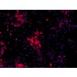 Human Pluripotent Stem Cell derived-Cortical Neurons immunostained for TBR1 (red) 200X