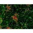 Human Pluripotent Stem Cell derived-Cortical Neurons immunostained for TBR1 (red) and beta tubulin III (green) 200X
