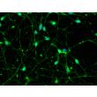 Human Pluripotent Stem Cell derived-Dopaminergic Neurons, immunostained for tyrosine hydroxylase (green) 400X