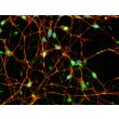 Human Pluripotent Stem Cell derived-Dopaminergic Neurons, immunostained for beta tubulin III (red) and tyrosine hydroxylase (green) 400X