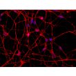 Human Pluripotent Stem Cell derived-Dopaminergic Neurons, immunostained for beta tubulin III (red) 400X