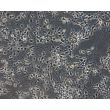 Human Pluripotent Stem Cell derived-Dopaminergic Neurons Phase Contrast 200X