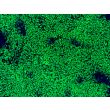 hPSC-Derived Neural Crest Cells (hPSC-NCC) - Immunostaining for SOX10, 100x
