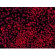 HPSC-Derived Neural Stem Cells (H9-NSC) – Immunostaining for Sox2, 200x