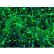 HPSC-Derived Neurons (H9-N) – Immunostaining for Tuj1, 200x