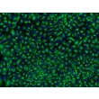 HPSC-Derived Neural Stem Cells (H9-NSC) – Immunostaining for Nestin, 200x