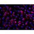 Human Pluripotent Stem Cell derived-Pericytes, immunostained for PDGFRβ (red) 200X