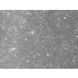Human Prostate Fibroblasts (HPrF) - Phase contrast, 200x.
