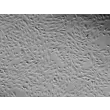 Human Pulmonary Artery Endothelial Cells (HPAEC) - Relief contrast, 100x.
