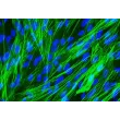 Human Pulmonary Artery Smooth Muscle Cells [HPASMC] - Immunostaining for α-SMA, 400x.
