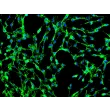 Human Pulmonary Fibroblasts (HPF) - Immunostaining for Fibronectin, 200x.
