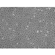 Human Pulmonary Microvascular Endothelial Cells (HPMEC) - Phase contrast, 100x.
