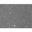 Human Rectal Microvascular Endothelial Cells (HRecMEC), Phase Contrast, 100x.
