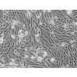 Human Renal Coritcal Epithelial Cells (HRCEpiC) - Phase contrast, 200x.
