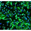 Human Renal Coritcal Epithelial Cells (HRCEpiC) - Immunostaining for CK-18, 200x.
