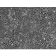 Human Renal Mesangial Cells (HRMC) - Phase contrast, 100x.