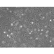 Human Retinal Astrocytes (HRA) - Phase contrast, 100x.
